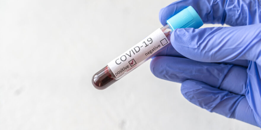 coronavirus-testing-2021-08-27-23-58-25-utc